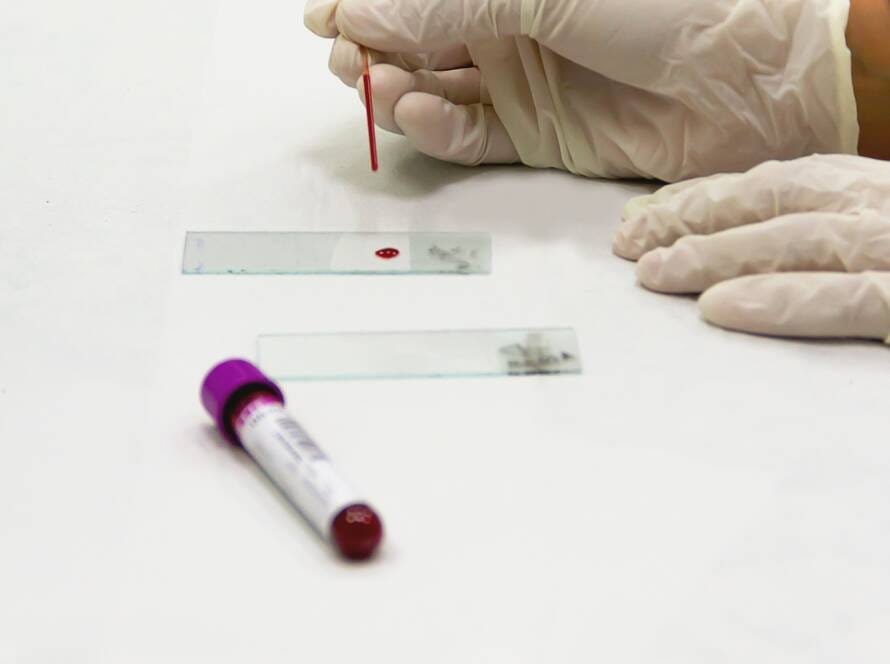Técnico de laboratorio preparando una muestra de sangre para analizar la ferritina y el hierro en un deportista